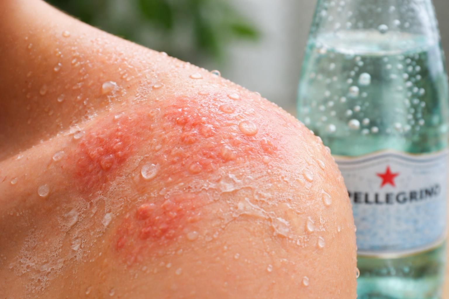 découvrez les effets secondaires potentiels de l'eau san pellegrino sur votre peau et comment elle peut influencer votre hydratation et santé cutanée.